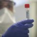 A laboratory operator wearing protective gears runs tests on sample possibly infected with Covid-19 at the Henri Mondor Hospital in Creteil, near Paris, on March 6, 2020 as the novel coronavirus strain that erupted in China this year and causes the COVID-19 disease already left nine dead in France and made hundreds ill. (Photo by Thomas SAMSON / AFP)